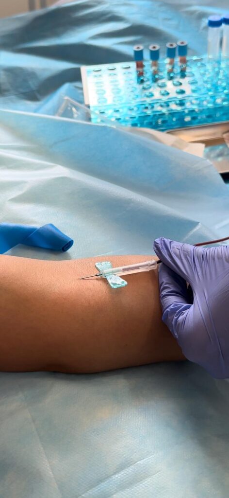 Regenerating PRP & Dermapen