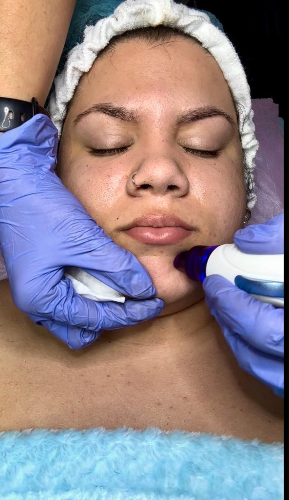 Hydrafacial